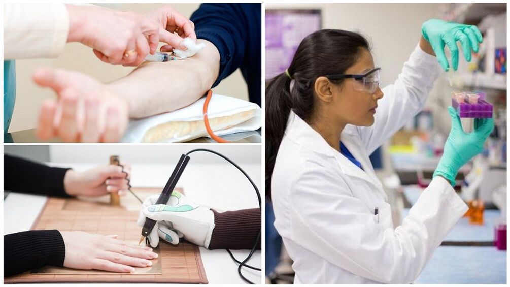 Metody diagnostyczne służące do wykrywania pasożytów w organizmie