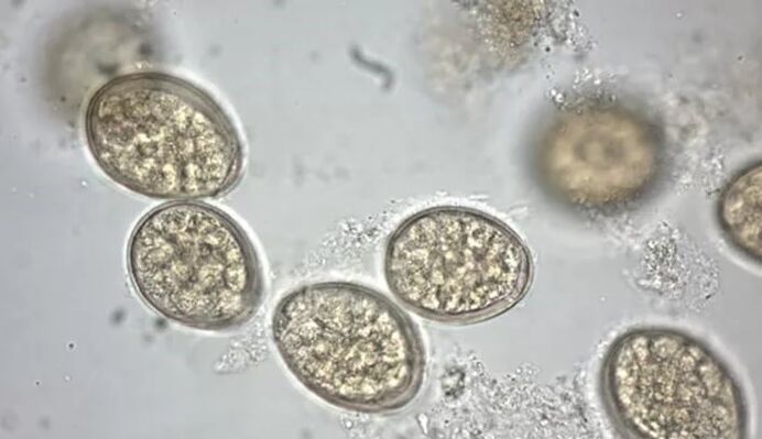 pasożyty pod mikroskopem